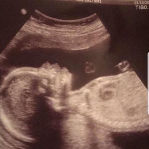 Meet your Posher, Bo